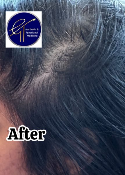 GT Restore Hair1
